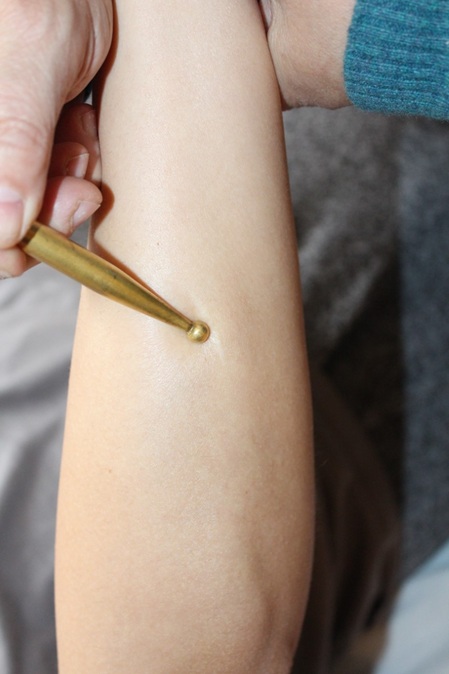 Narbentherapie in unserer Physiotherapiepraxis in Hannover